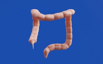 10 Fatores de Risco e Prevalência na Epidemiologia das Hemorroidas