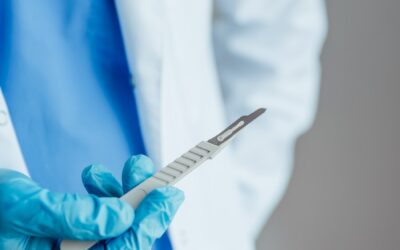 Ligadura Interesfincteriana (LIFT): Benefícios da Solução Eficaz para Fístula Anal