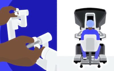 Cirurgia Robótica: Vantagens para Tratar o Câncer Colorretal