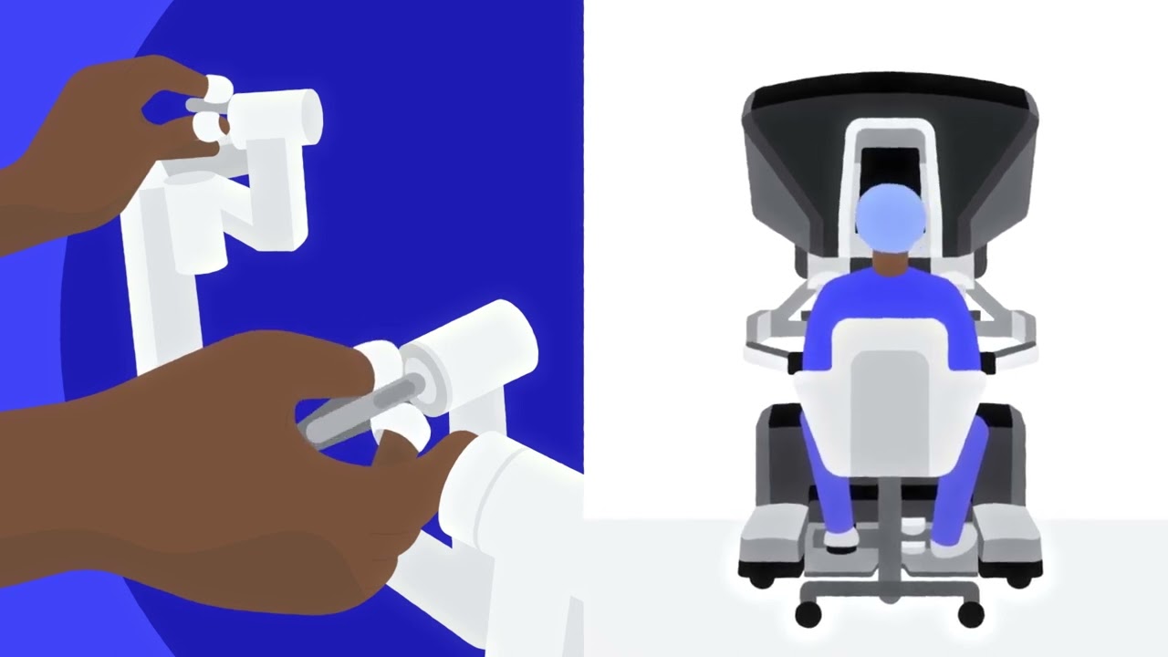 Cirurgia Robótica: Vantagens para Tratar o Câncer Colorretal