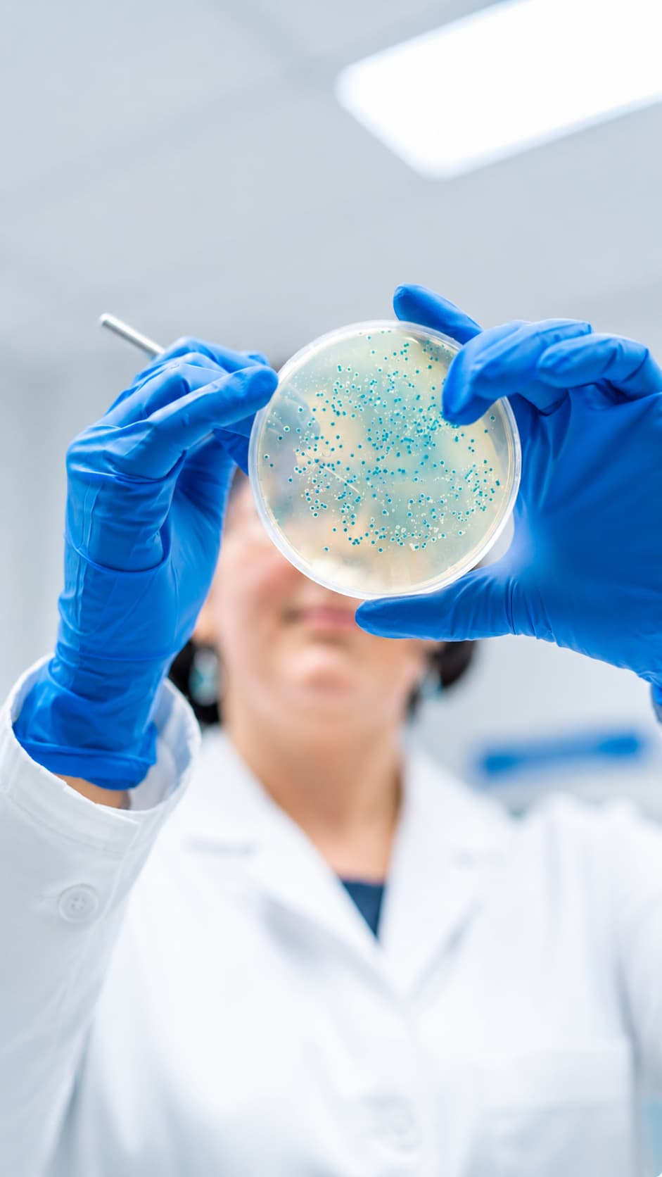 análise laboratorial Sequenciamento genético da microbiota intestinal